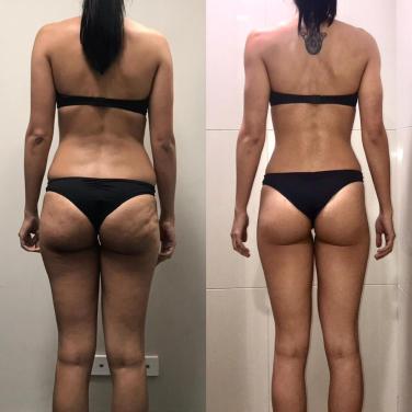 5Star-Physique-Boutique-Gym-Before-After-28